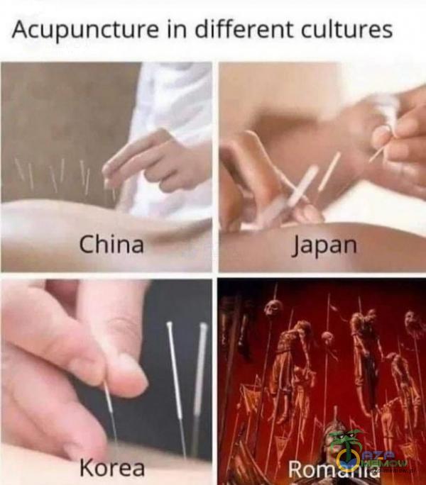Acupuncture in different cultures
