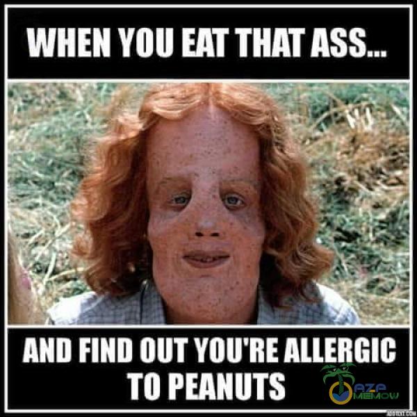 WHEN ASS.„ ś AND FIND OUT YOU RE ALLERGIC TO PEANUTS