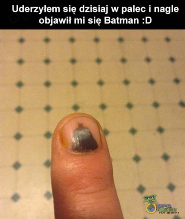 Uderzyłem się dzisiaj w palec i nagle objawił mi się Batman :D