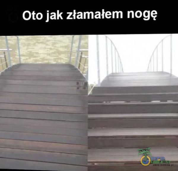 Oto jak złamałem nogę