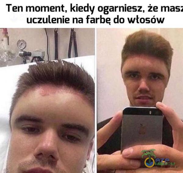 Ten moment. kiedy ogarniesz. że masz uczulenie na farbę do włosów