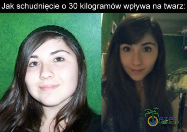 Jak schudnięcie (› 30 kilogramów wpływa na twarz.