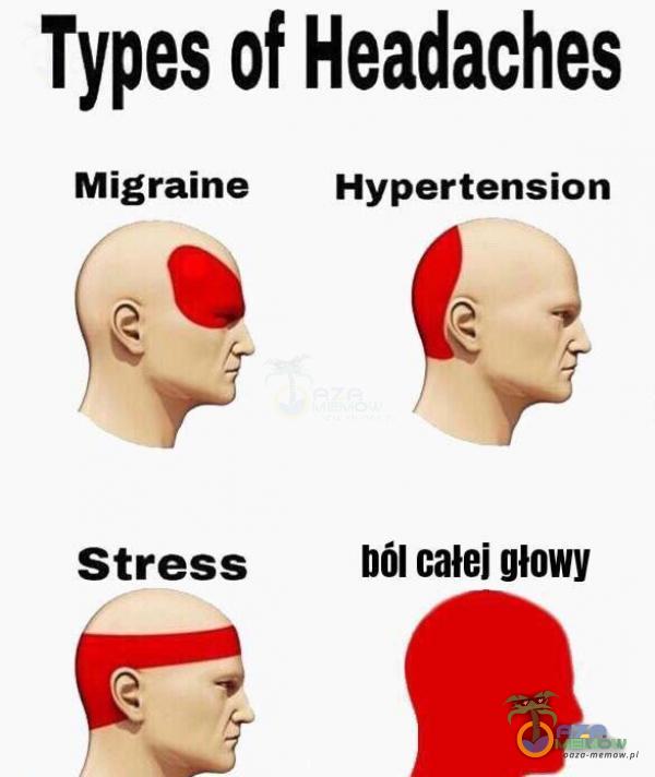 Types of Headaches Migraine Hypertension ed > sa r Stress ból całej głowy ; 1