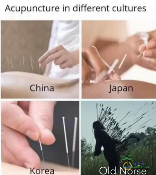 Acupuncture in different cultures China Korea Japan Old N orse